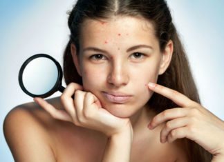Reduce Your Acne With Healthy Nutrition Foods To Reduce Acne