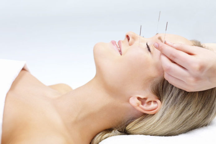 Benefits Of Acupuncture