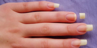 How To Take Care Of Broken Nails Broken Nails