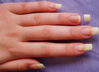 How To Take Care Of Broken Nails Broken Nails
