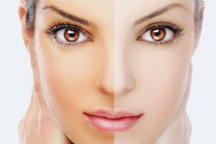 How To Improve Skin Tone