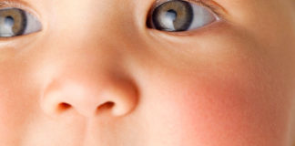 10 Common Skin Rashes in Children skin rashes in children