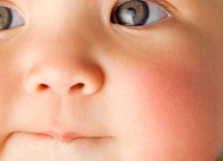 10 Common Skin Rashes in Children skin rashes in children