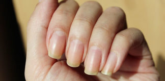 How to get rid of yellow nails at home in some easy ways get rid of yellow nails