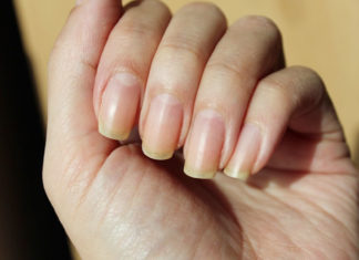 How to get rid of yellow nails at home in some easy ways get rid of yellow nails
