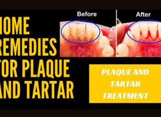 Home Remedies to Remove Tartar And Plaque From Teeth home remedies to remove tartar