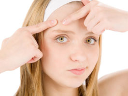 What are Whiteheads and How to Remove them Naturally whiteheads