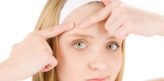 What are Whiteheads and How to Remove them Naturally whiteheads