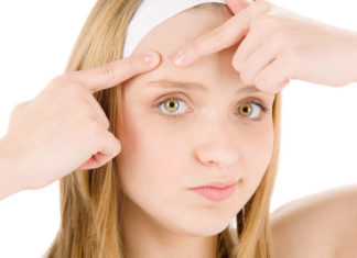 What are Whiteheads and How to Remove them Naturally whiteheads