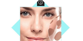 How to Get Rid of Hyperpigmentation on Face how to get rid of hyperpigmentation