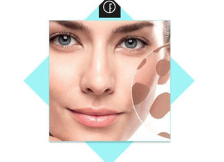 How to Get Rid of Hyperpigmentation on Face how to get rid of hyperpigmentation