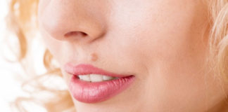 How to Remove Moles From Face at Home how to remove moles