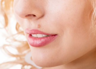How to Remove Moles From Face at Home how to remove moles