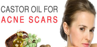 Amazing Benefits of Castor Oil for Acne castor oil for acne