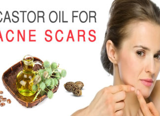 Amazing Benefits of Castor Oil for Acne castor oil for acne