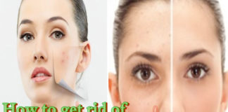 What are these Brown Spots on Face and How to Treat Them brown spots on face