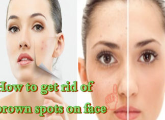 What are these Brown Spots on Face and How to Treat Them brown spots on face