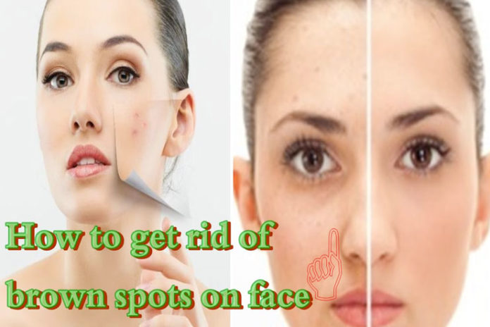 brown spots on face