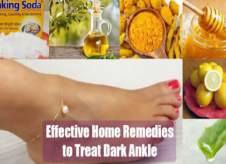 Home Remedies for Dark Ankles to Save you from Embarrassment Home remedies for dark ankle