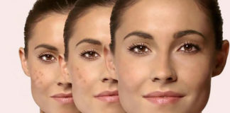 Know Some Amazing Dark Spot Corrector for Skin dark spot corrector