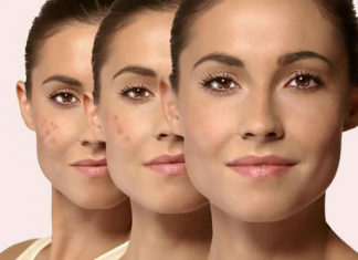 Know Some Amazing Dark Spot Corrector for Skin dark spot corrector