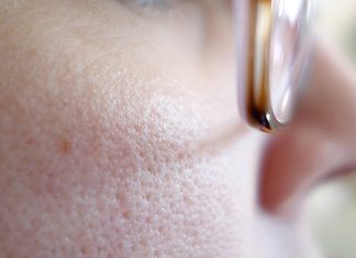 7 Tips On How To Unclog Pores – Cleanse Your Face! Unclog Pores