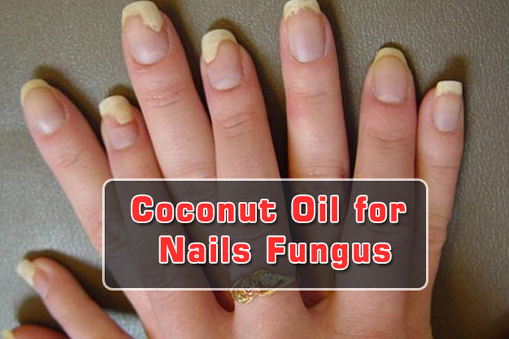 Pour coconut oil on your nails