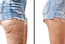 How To Lose Thigh Fat – Learn Best Tips And Make Your Thunder Thighs Thin! Lose-Thigh-Fat