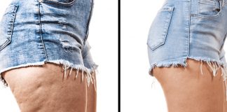 How To Lose Thigh Fat – Learn Best Tips And Make Your Thunder Thighs Thin! Lose-Thigh-Fat