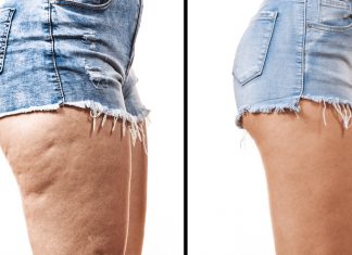 How To Lose Thigh Fat – Learn Best Tips And Make Your Thunder Thighs Thin! Lose-Thigh-Fat