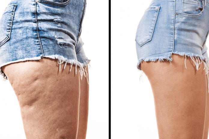 Lose-Thigh-Fat