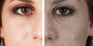 How Smoking Affects Your Skin, Know Its Effects – Don’t Punish Your Skin!