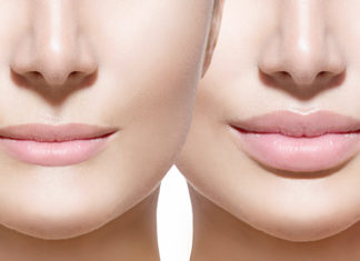 Intricacies Of Different Types Of Lips And Interesting Facts – Know What Is Your Shape! Types-Of-Lips
