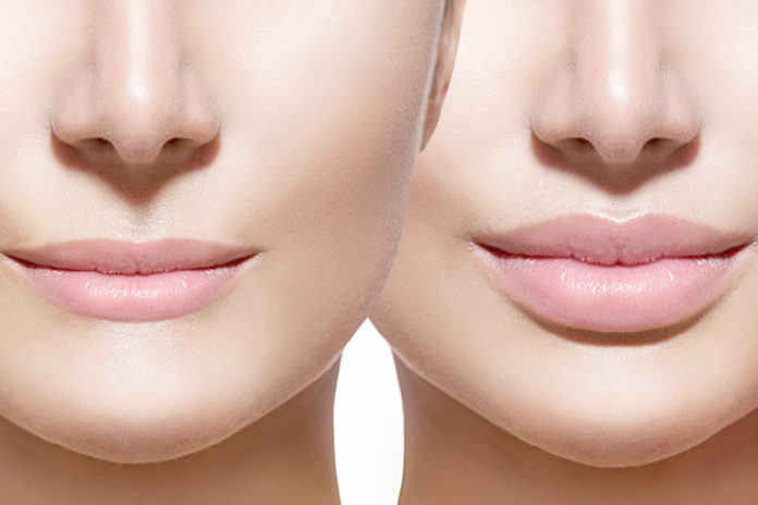 Types-Of-Lips
