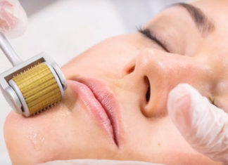 How to Use Dermaroller For Acne Scars – Flush Out All The Acne! Dermaroller-For-Acne-Scars