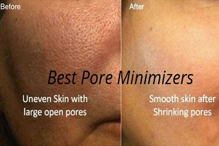 Essential Factors To Study Before Buying Pore Minimizers