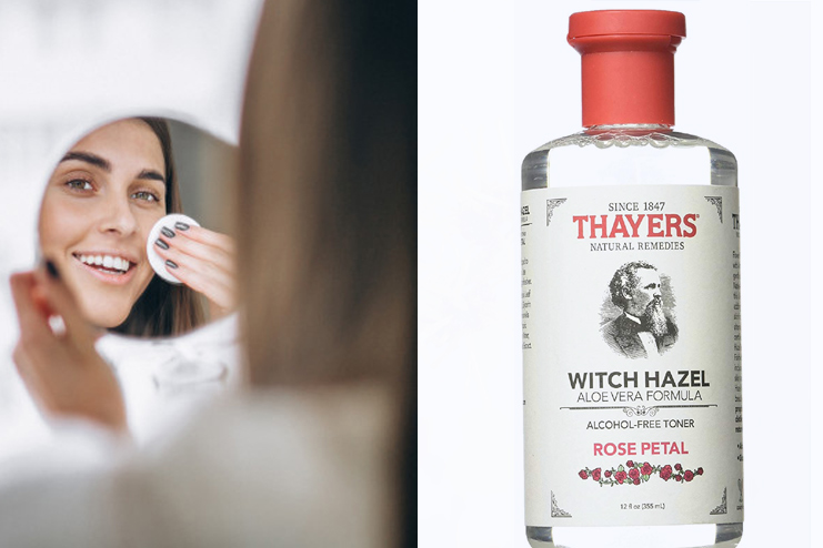 How-Does-Witch-Hazel-Help