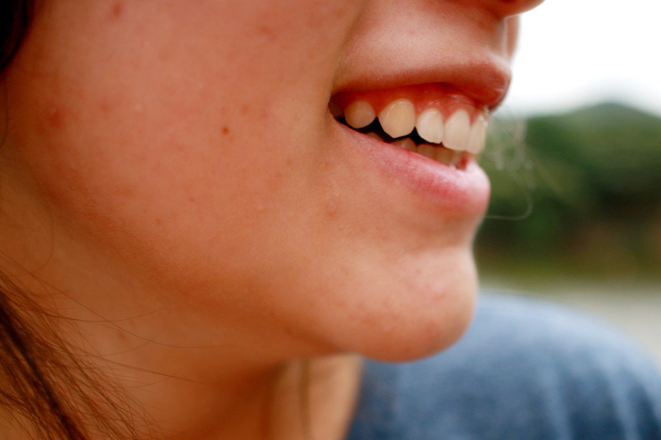 Minimize-Large-Pores