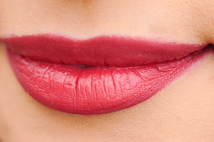 treat-chapped-lips