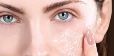 11 Best Rated Chemical Peels At Home – Empower Your Skin! 11 Best Rated At Home Chemical Peels