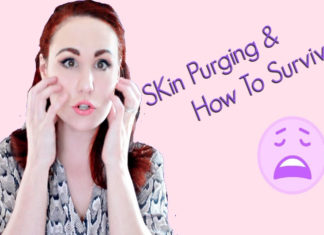 Good To Know Things About Skin Purging! A Skin Disaster! Good To Know Things About Skin Purging