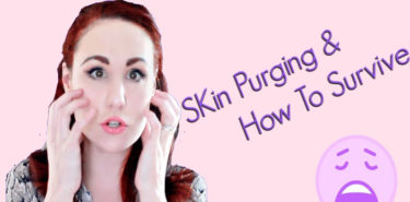 Good To Know Things About Skin Purging! A Skin Disaster! Good To Know Things About Skin Purging
