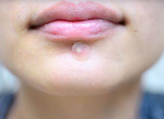 10 Best Rated Pimple Patches That Will Work On Your Skin! 10 Best Rated Pimple Patches That Will Work On Your Skin