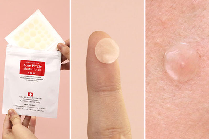 Things You Should Know About A Pimple Patch