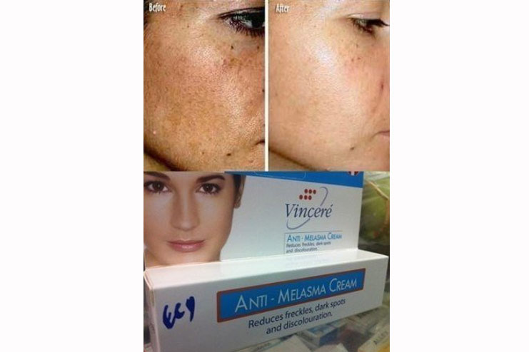 Vin 21 Anti-Melasma And Pigmentation Cream