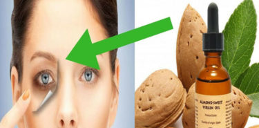 Almond Oil for Dark Circles – 7 Benefits And 12 Remedies! Almond Oil for Dark Circles 7 Benefits And 12 Remedies