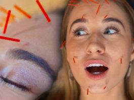 Facial Acupuncture – Everything You Need To Know About It! Facial Acupuncture Everything You Need To Know About It