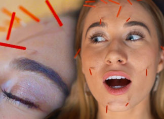 Facial Acupuncture – Everything You Need To Know About It! Facial Acupuncture Everything You Need To Know About It