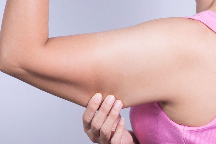 What Causes Flabby Arms