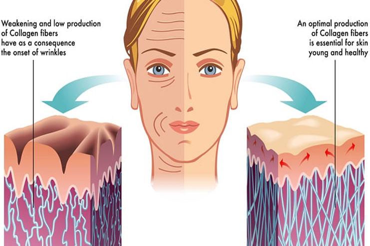 What is Collagen in Skin